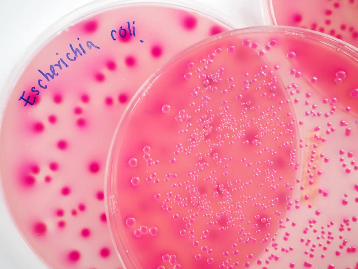Escherichia coli (E. Coli) growth